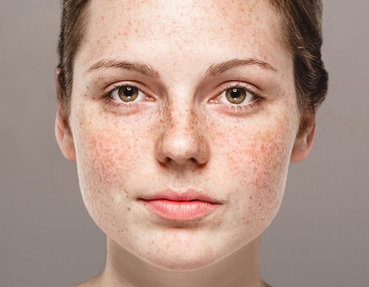 Imagen destacada de “Tonos y pigmentos en freckling:cómo elegir el más adecuado”