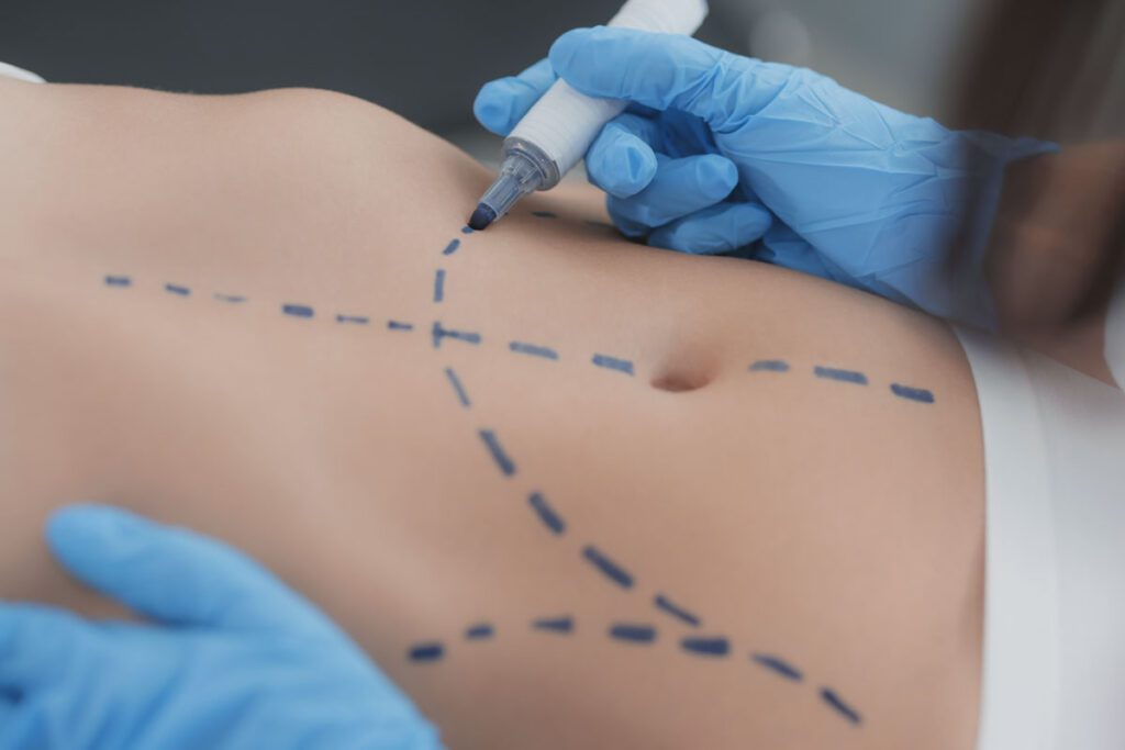 Auxiliar en Medicina Estética: especialización en el Quirófano