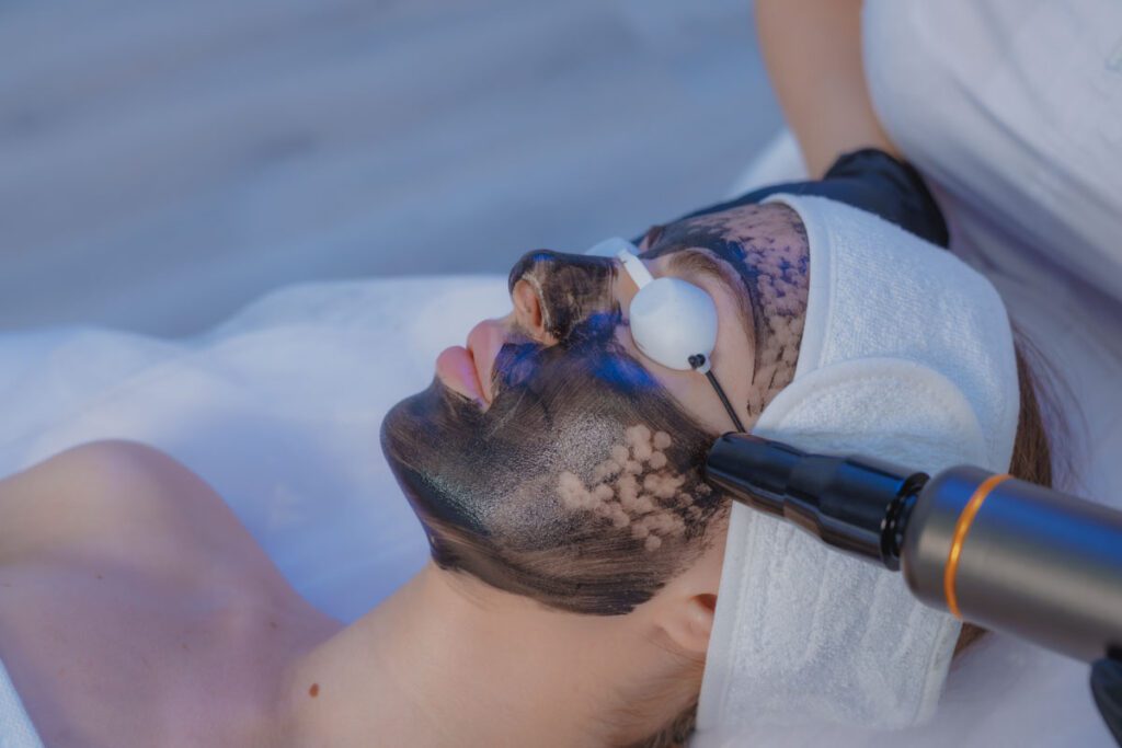 Hollywood Peel (Carbon Peel)