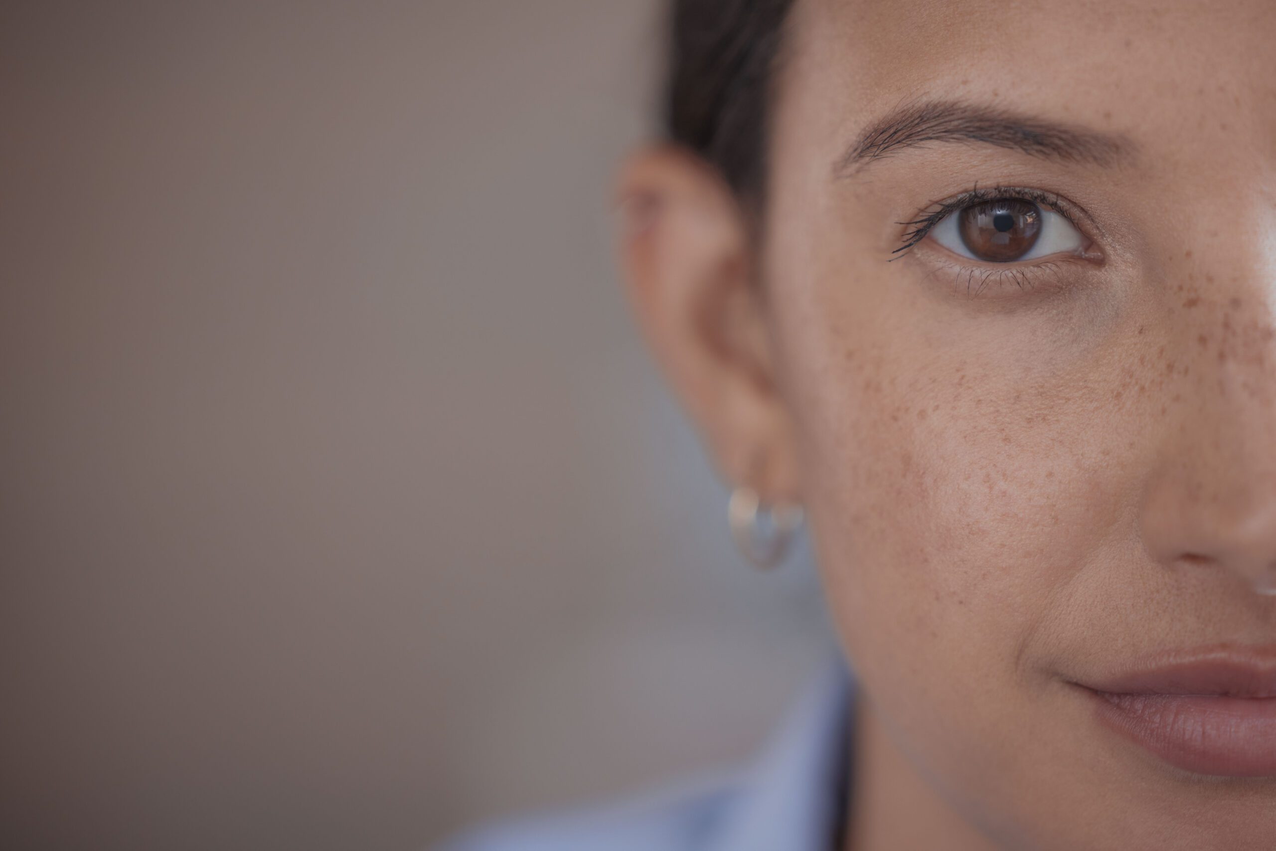 Micropigmentación de Pecas (Freckling)