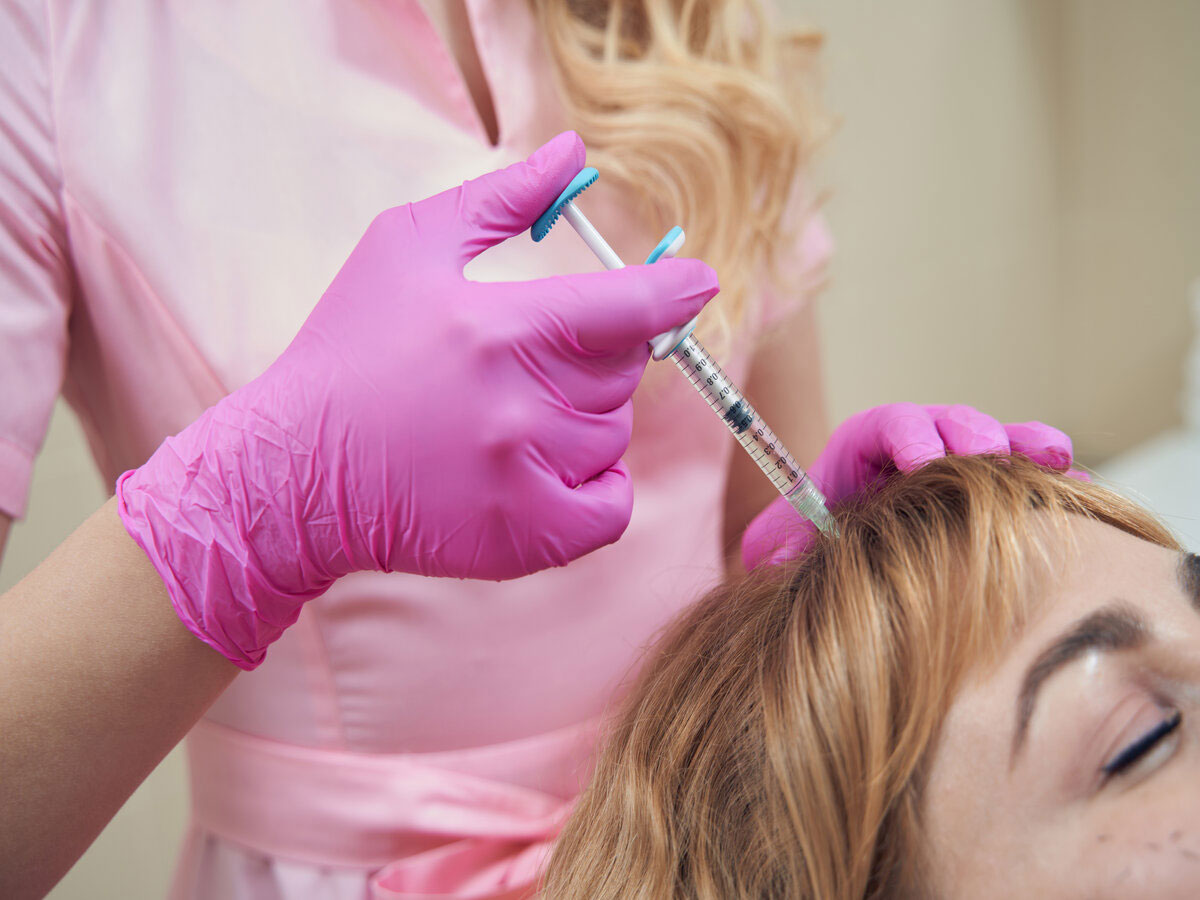 Imagen destacada de “Mesoterapia capilar, el mejor aliado contra la pérdida del cabello”