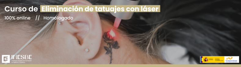 Curso Eliminación de tatuajes con láser