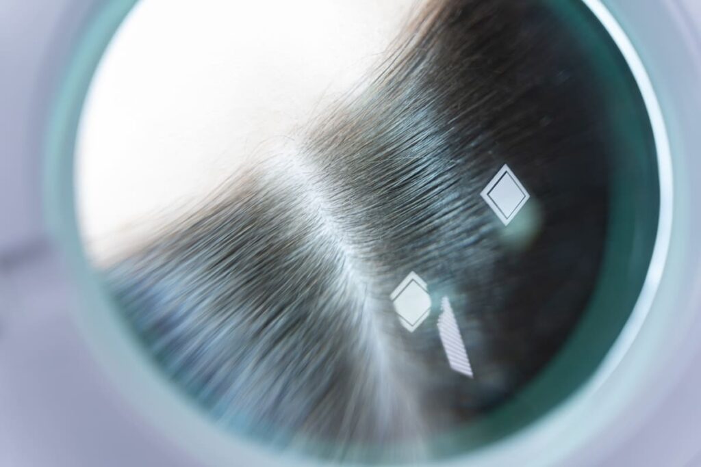 Aplicación de tratamiento capilar para la salud del cuero cabelludo en salón de belleza.