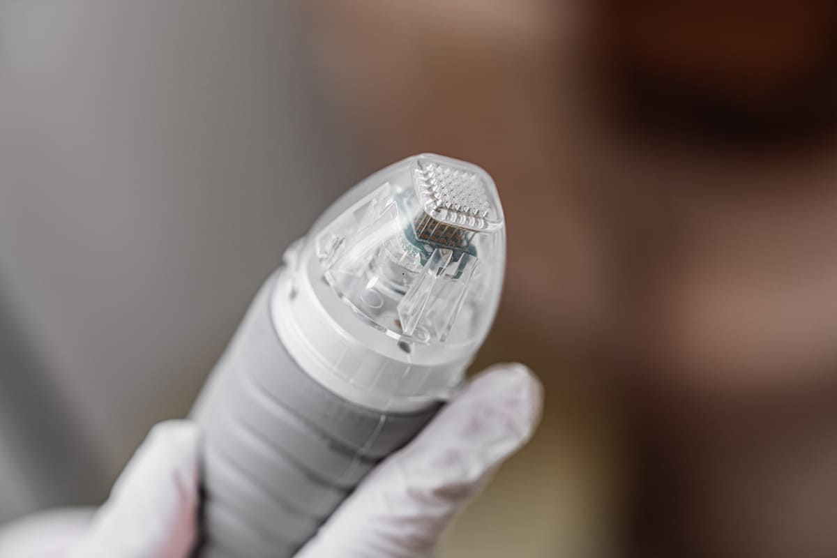Imagen destacada de “Cómo especializarte en microneedling si ya trabajas en estética”
