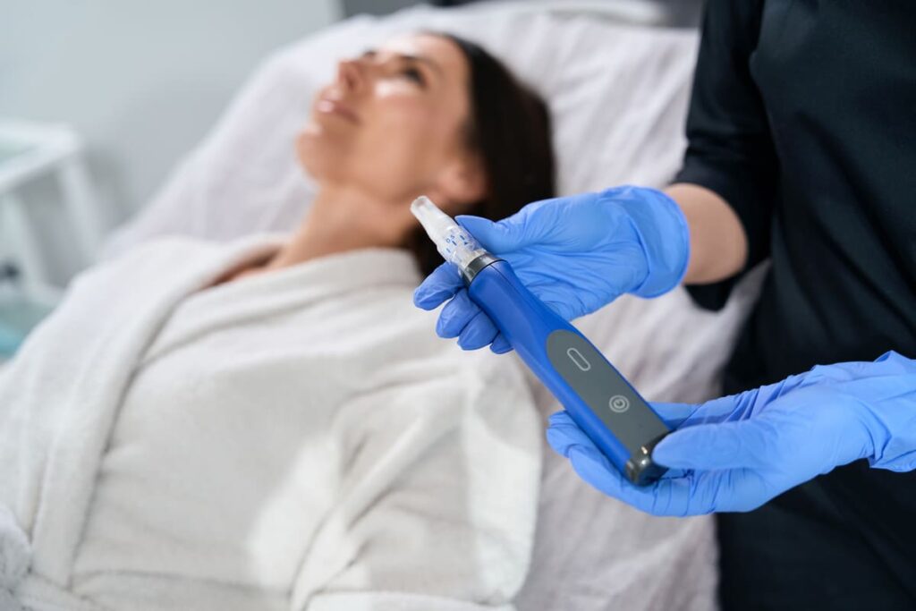 Primer plano de un dispositivo de dermapen siendo utilizado por una experta tras especializarte en microneedling.